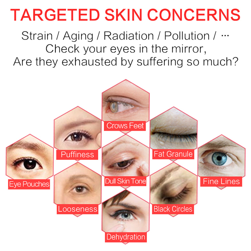 جهاز العناية بالمنطقة المحيطة بالعينين Sonic Thermal Eye & T-Zone Care Wand – 3 ميغاهرتز فوق صوتي، استيراد أيوني، تدليك حراري بدرجة حرارة 40 مئوية لعلاج الهالات السوداء والانتفاخات والخطوط الدقيقة – أحمر كولا / أبيض تفاحي / ذهبي وردي63081146768001112