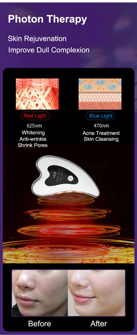 Heart-Shaped Gua Sha Facial & Scalp Massager – High-Frequency Vibration, 45 °C Heat Therapy, Red & Blue LED for Wrinkles, Pores, Acne & Puffiness – IPX6 Waterproof – White/Silver/Black63081172214403113